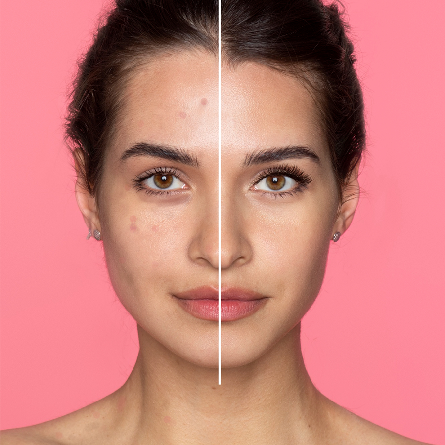 Mud Rub Exfoliator Gel Niacinamide Rubbing Skin Gel