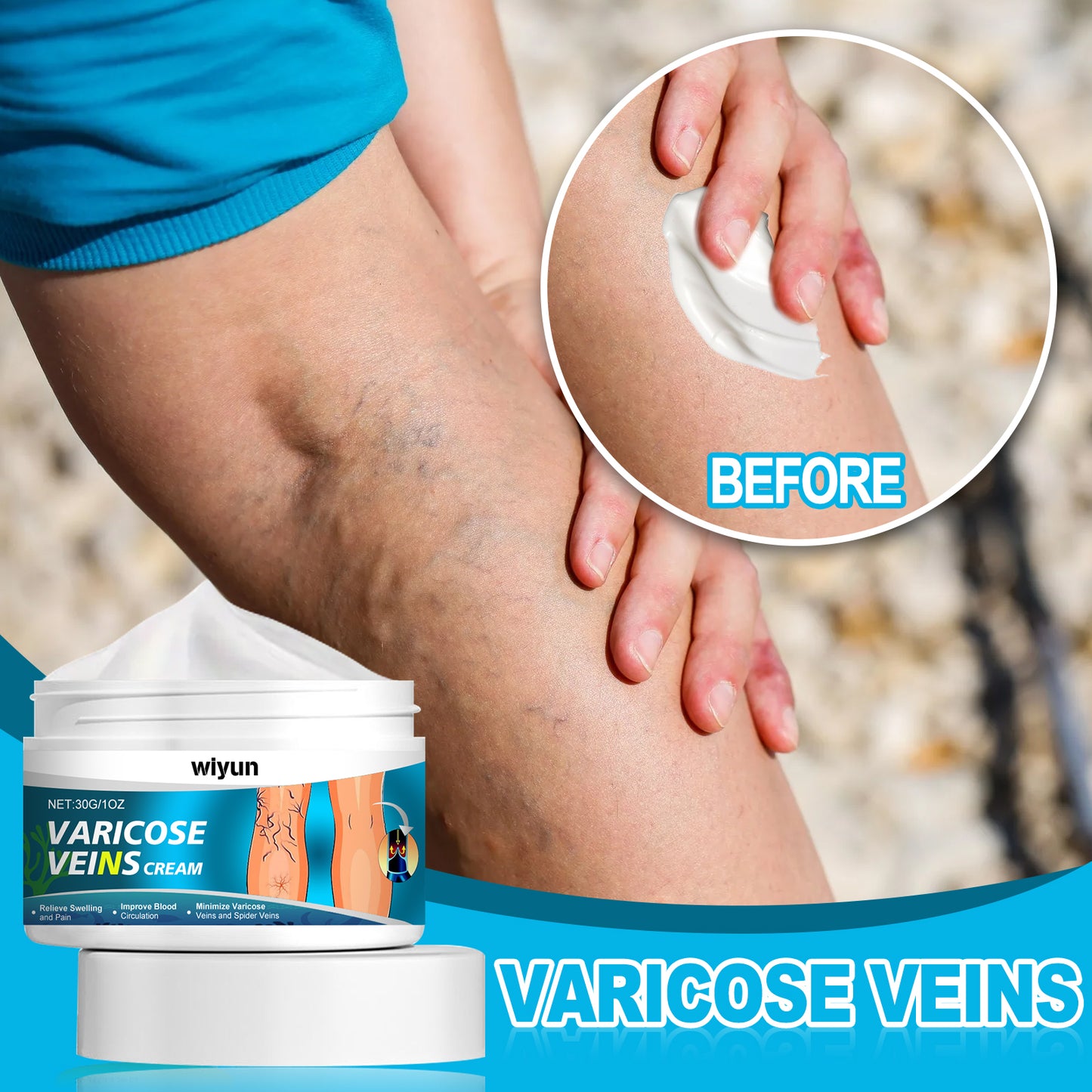 Wiyun Varicose Veins Cream, Muscle Soreness And Swelling Relief Discomfort Smoothing Blood Vessel Massage Cream