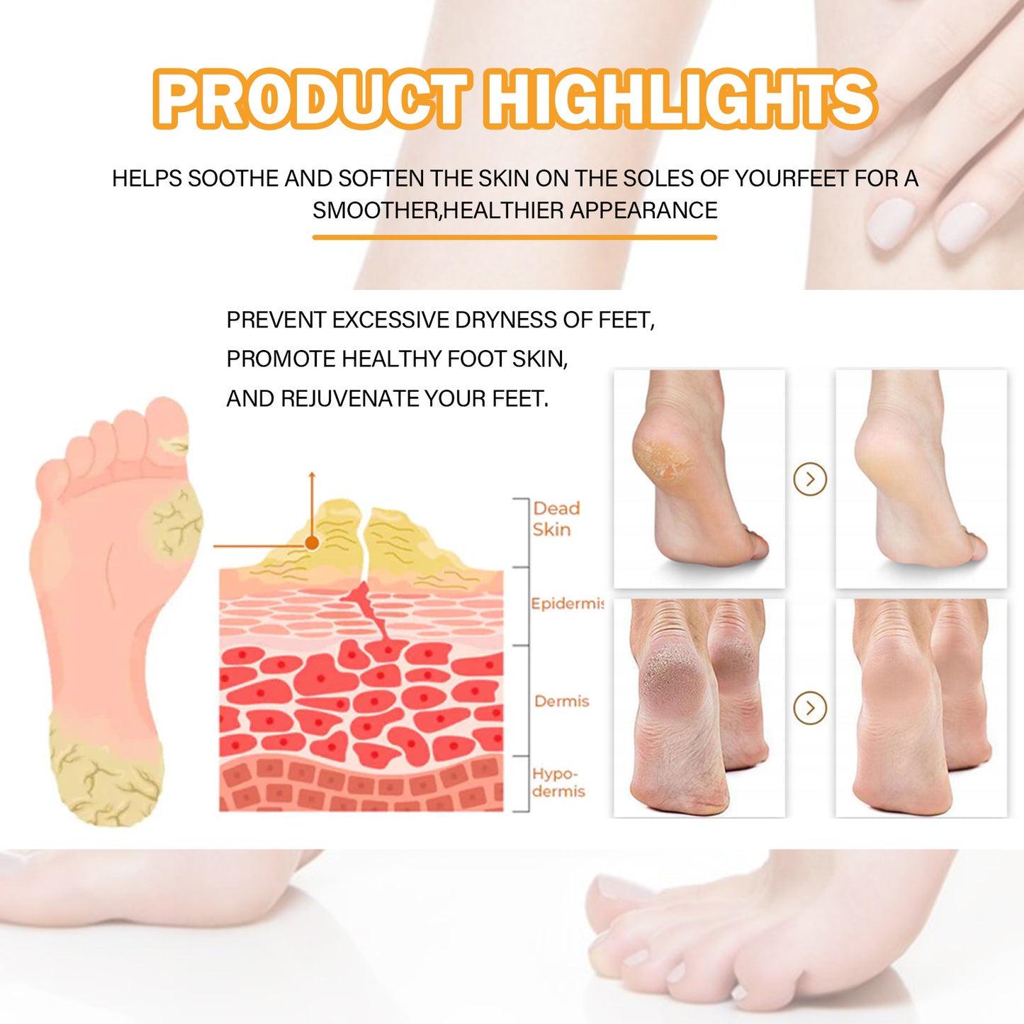 OUHOE Foot Calluses Moisturizing Spray, Repair Heel Calluses, Remove Dead Skin, Moisturize And Moisturize Foot Care