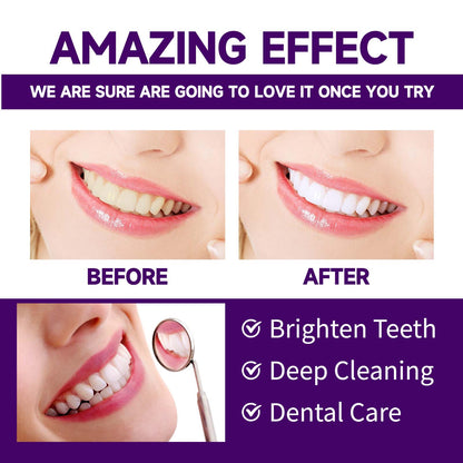 Oralhoe Purple Tooth Powder, Bad Breath Care Fresh breath Clean Teeth Whitening Beauty powder