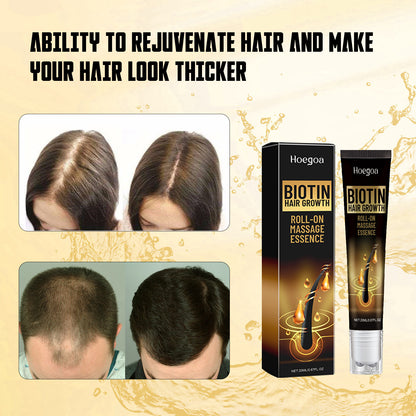 Hoegoa Biotin Hair Growth Roll On Massage Essence, Strong Hair Nourishing Hair Root Repair Dry Hair Essence