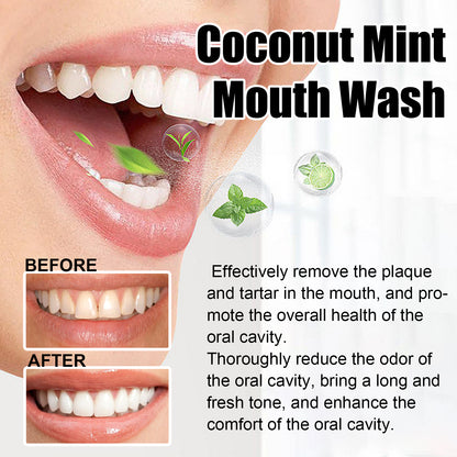 Oralhoe Teeth Rinse, Deep Clean Mouth Fresh, Deodorizing And Whitening Teeth Stain Removing Mouthwash