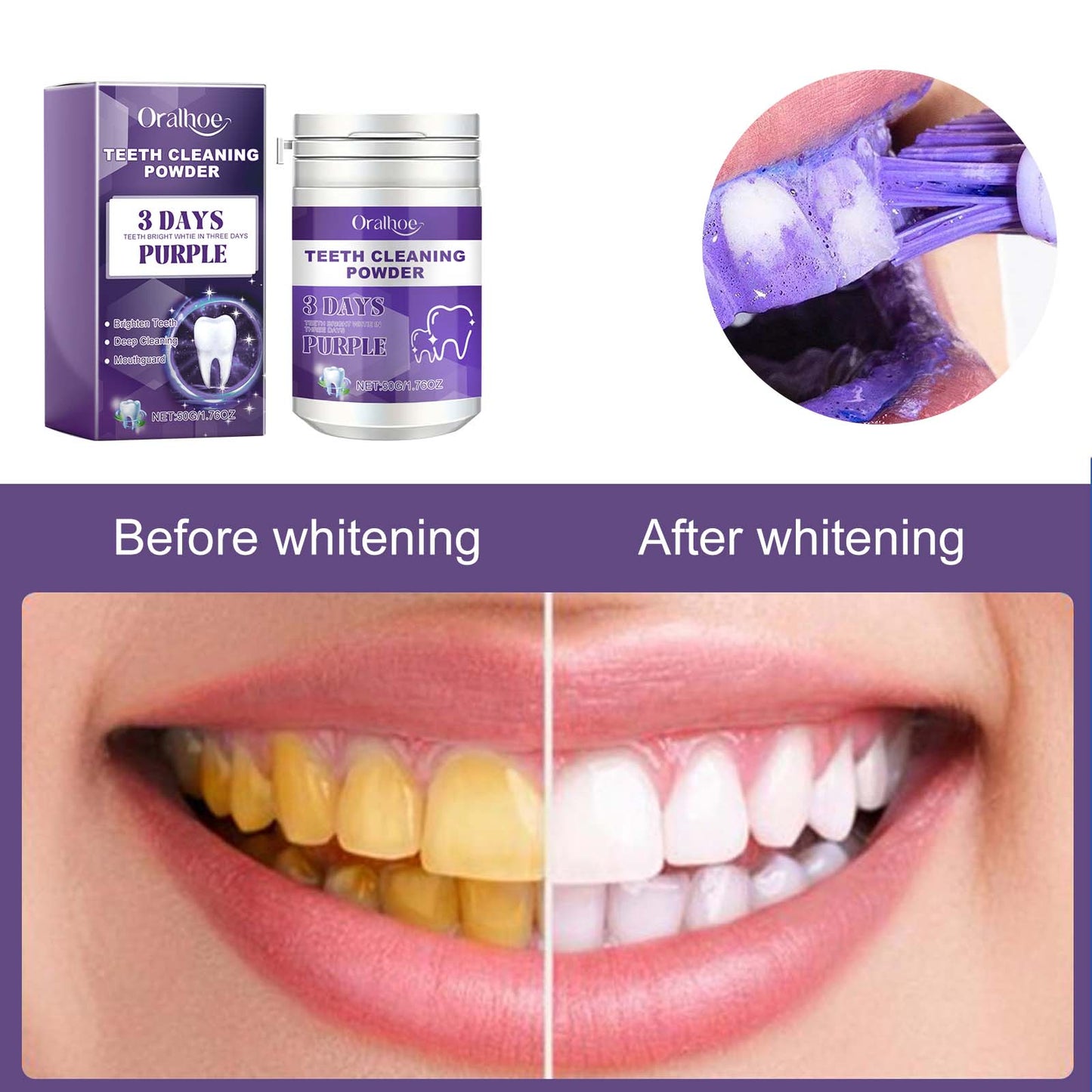 Oralhoe Teeth Cleaning Powder, Fresh Breath Tartar Stone White Teeth Cleaning Powder Oral Care