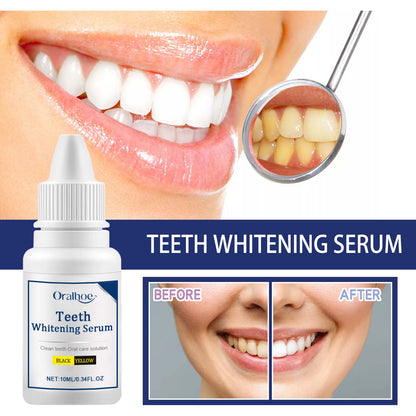 Oralhoe Teeth Whitening Serum, Remove Stains Yellow Dirt Deep Cleaning Whitening Essence