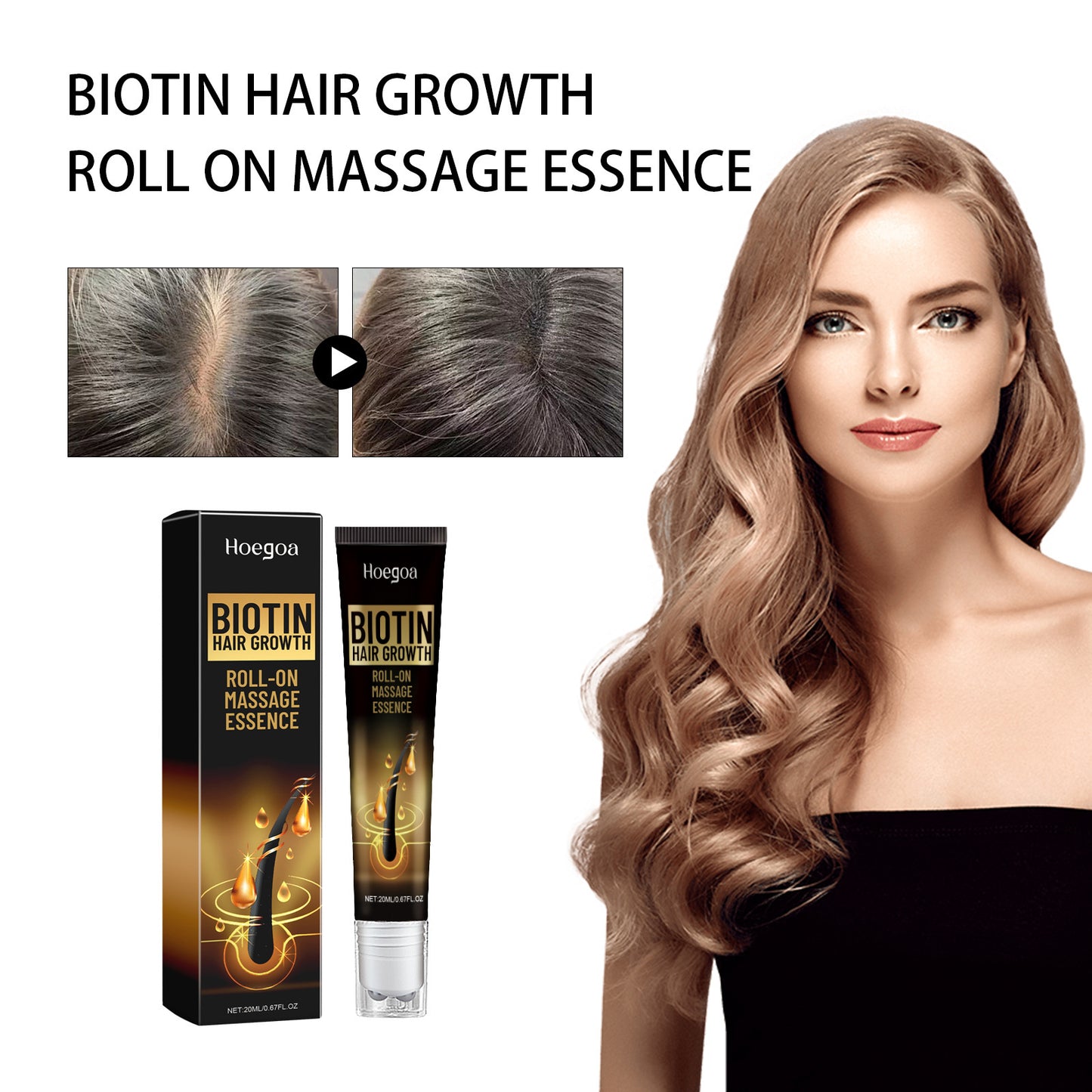 Hoegoa Biotin Hair Growth Roll On Massage Essence, Strong Hair Nourishing Hair Root Repair Dry Hair Essence