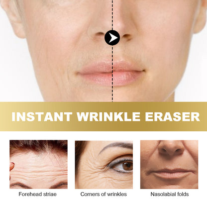 West&Month Instant Wrinkle Eraser, Fade Facial Wrinkle Moisturizing Nourishing Firming Haun White Skin