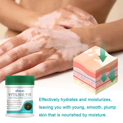 Ximonth Vitiligo Fix Revitalizing Elixir, Lighten Skin Spots Even Skin Tone Moisturizing Body Care Repair Cream