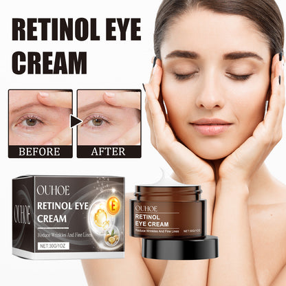 OUHOE Retinol Eye Cream, Desalination Smoothen Fine Lines Eye Pouch Black Rim Of The Eye Moist Nursing Play Tight Muscle Eye Cream