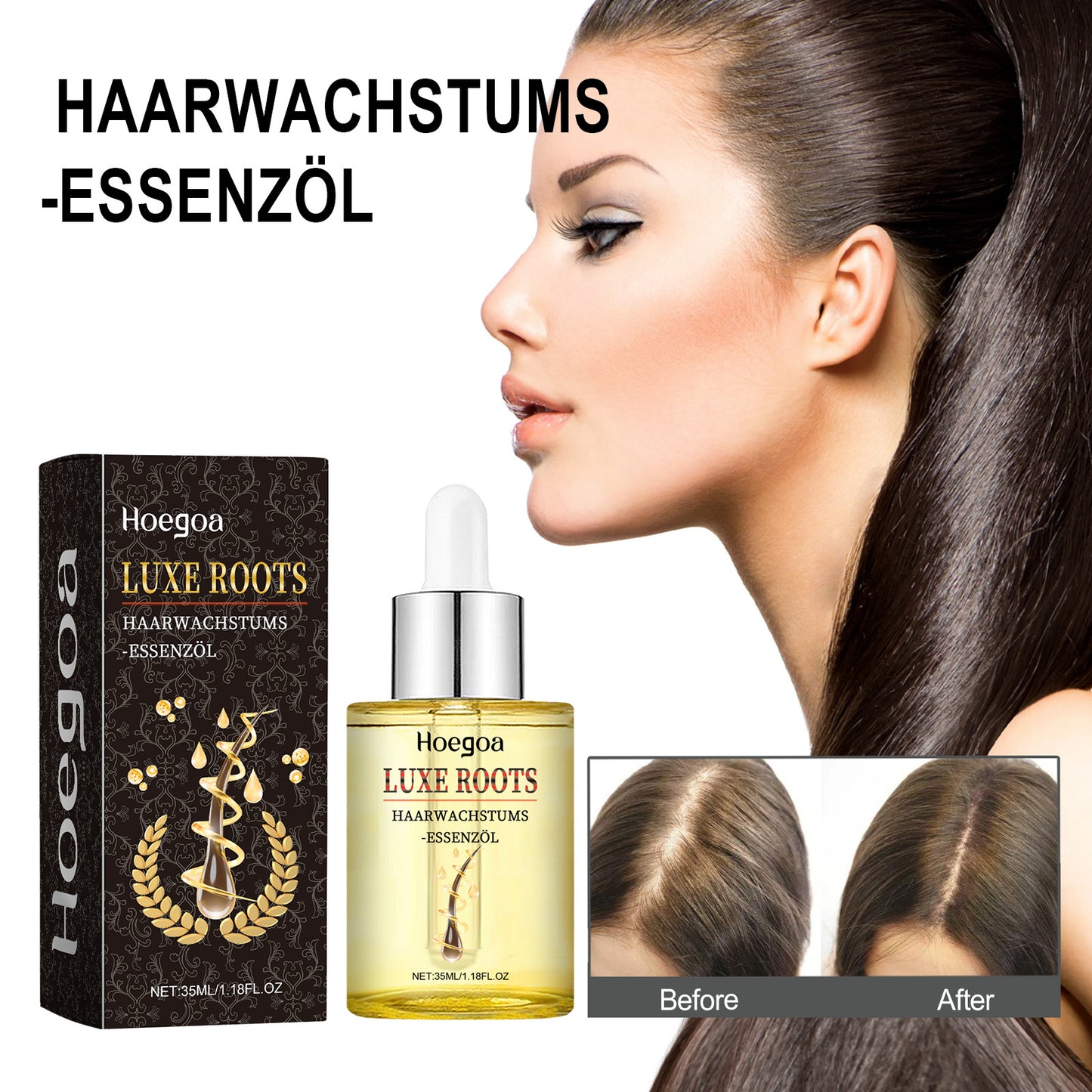 Hoegoa Hair Care Essence Scalp Massage Treatment Moisturizing, Supple And Volumizing Hair Care Essential Oil