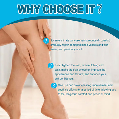 Wiyun Varicose Veins Cream, Muscle Soreness And Swelling Relief Discomfort Smoothing Blood Vessel Massage Cream