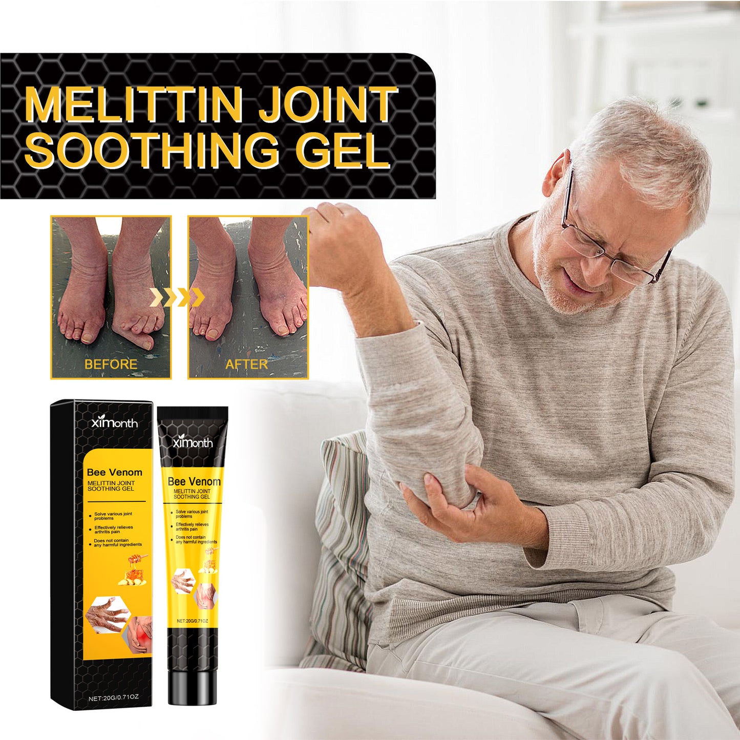 Ximonth Bee Venom Joint Care Gel Relieves Aching Muscles And Bones With Gentle Care And Improves Joint Stiffness And Discomfort Fog