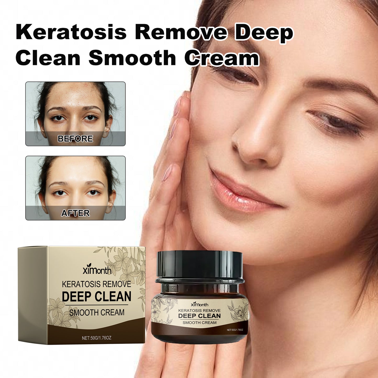 Ximonth Keratosis Remove Deep Clean Smooth Cream, Clear Skin Acne Exfoliating Unclog Pores Moisturizing Tender And Smooth Skin