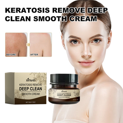 Ximonth Keratosis Remove Deep Clean Smooth Cream, Clear Skin Acne Exfoliating Unclog Pores Moisturizing Tender And Smooth Skin