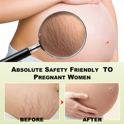 Wiyun Tummy Tucking Cream, Moisturizing And Smoothing Skin Repair Cream For Surgical Scars And Pregnancy Wounds