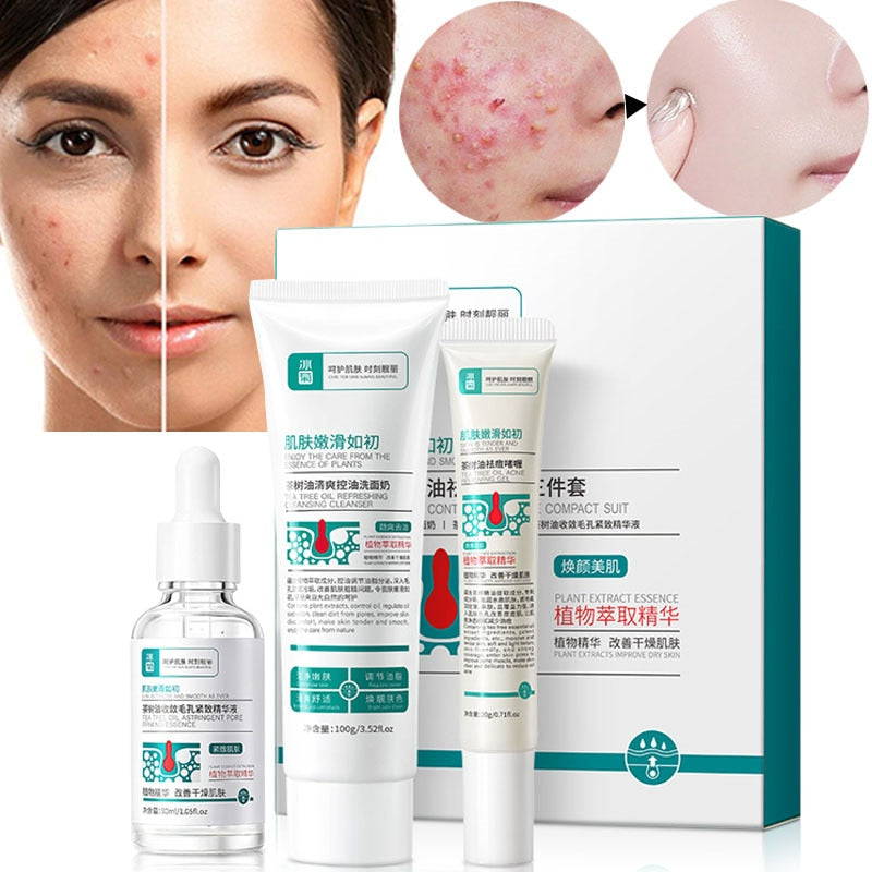 Acne Removal Cream Treatment Set Shrink Pore Serum 